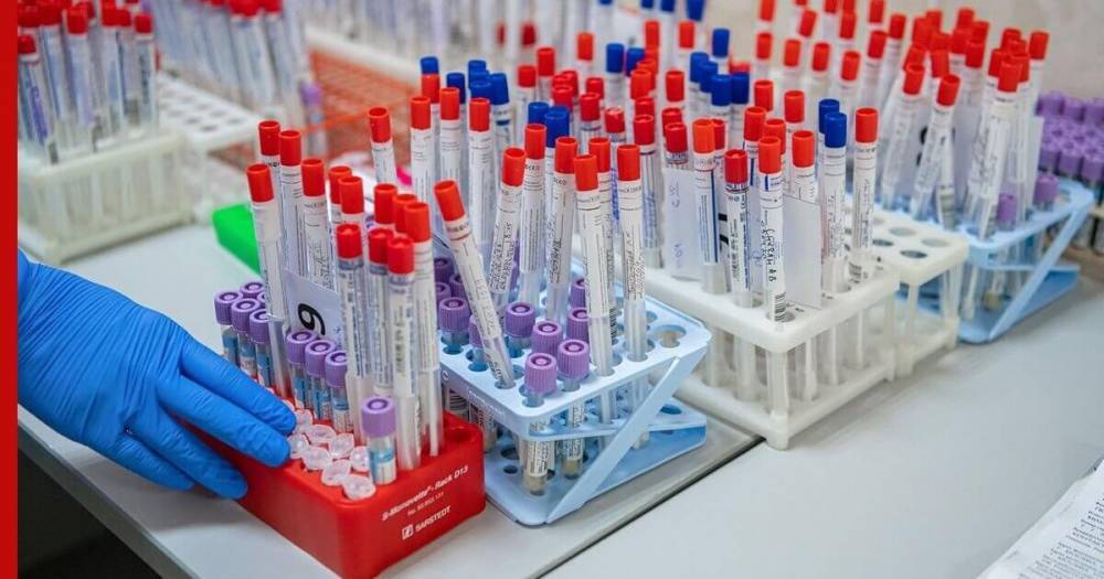В России зарегистрирована тест-система для определения антител к COVID-19 - profile.ru - Россия