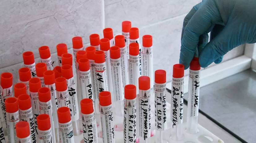 Число случаев заражения коронавирусом в Марий Эл достигло 597 - russian.rt.com - Россия - республика Марий Эл