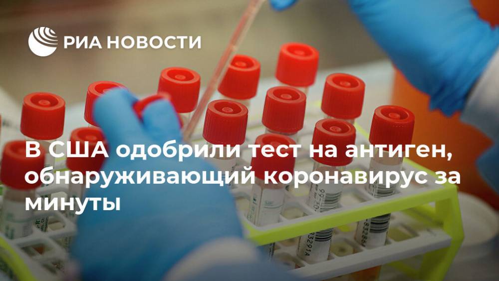 В США одобрили тест на антиген, обнаруживающий коронавирус за минуты - ria.ru - Москва - Сша