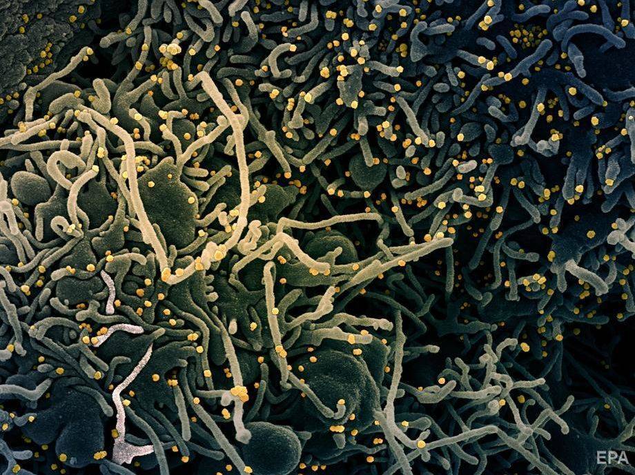 Ученые обнаружили коронавирус в сперме инфицированных мужчин. Возможно, COVID-19 передается половым путем - gordonua.com