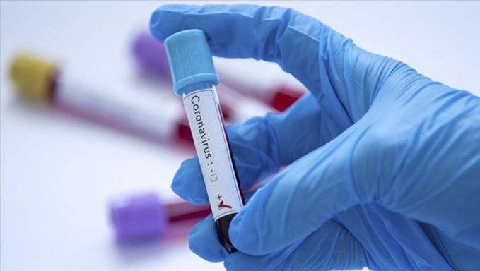 Биолог рассказала, почему тесты на коронавирус могут давать ошибочный результат - vm.ru - Сша