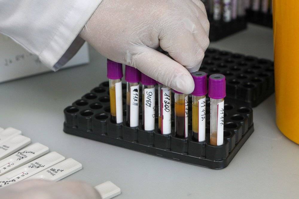 Число проведенных в России тестов на коронавирус превысило 5,6 миллиона - vm.ru - Россия