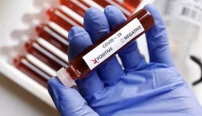 ВОЗ не удалось определить долю населения для развития иммунитета к коронавирусу - vm.ru