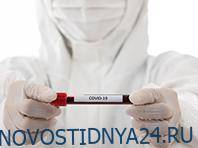 Найден белок, показывающий, как будет протекать заражение COVID-19 - novostidnya24.ru