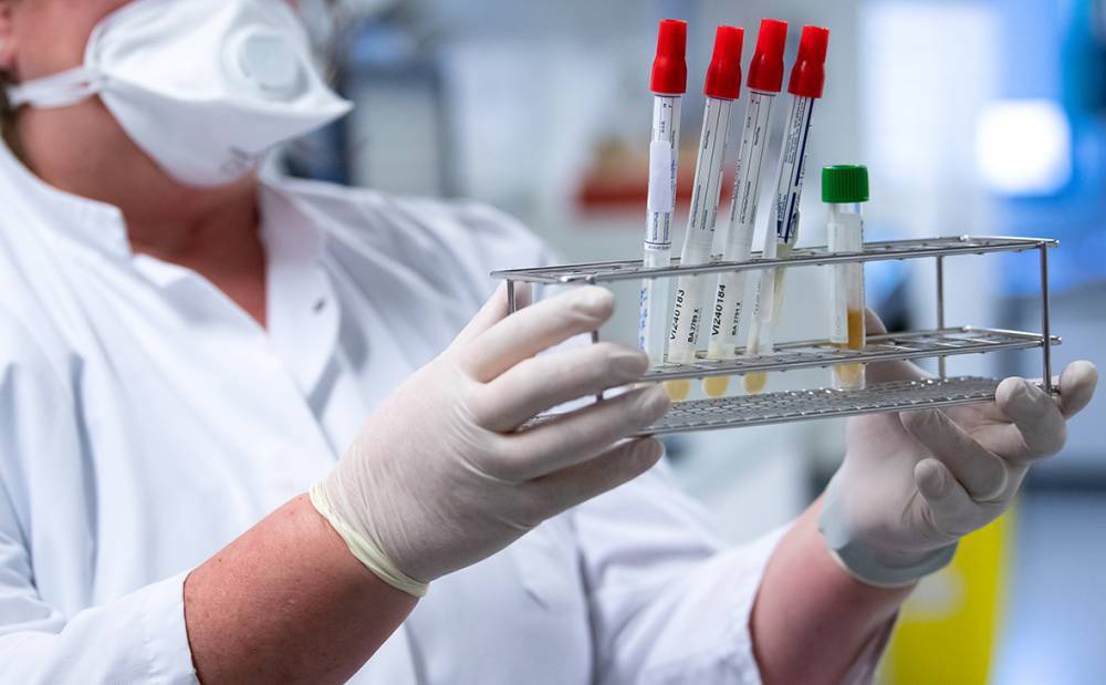 Лабораторный центр за сутки обследовал больше 300 человек с подозрением на коронавирус - inform.zp.ua