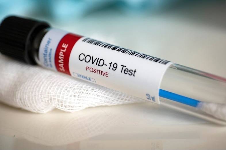 Ученые нашли средство для полной блокировки коронавируса - vm.ru - Сша - штат Калифорния