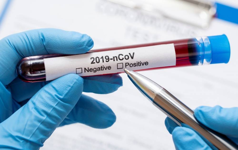 Более 60 стран призвали расследовать происхождение коронавируса - rbc.ua - Украина - Австралия - Женева - Евросоюз