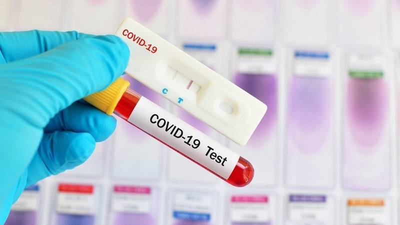 В Запорожской области количество инфицированных COVID-19 достигло 382 человек - inform.zp.ua - Украина - Запорожская обл.