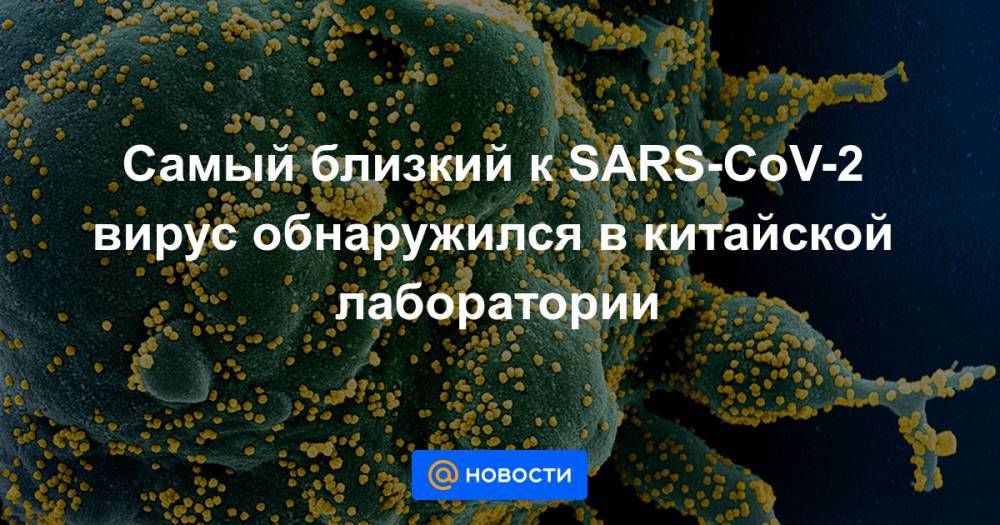 Михаил Щелканов - Самый близкий к SARS-CoV-2 вирус обнаружился в китайской лаборатории - news.mail.ru - Сша - Китай