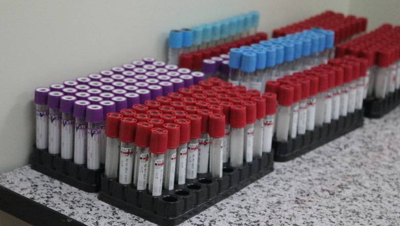 В оперштабе прокомментировали информацию о намеренном заражении тюменцев COVID-19 - nashgorod.ru - Люксембург