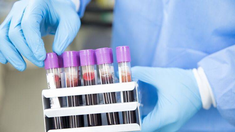 В США заявили об успешных испытаниях ДНК-вакцины от коронавируса - inforeactor.ru - Сша