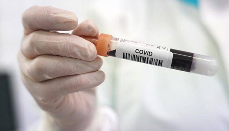 В Бразилии разработали первый в мире генетический тест на коронавирус - newtvnews.ru - Сша - Бразилия