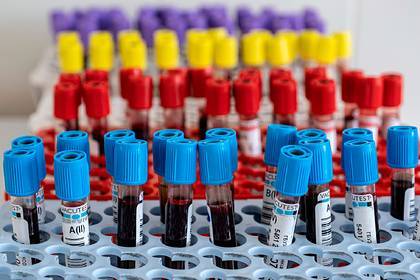 Лаборатория «Инвитро» раскрыла результаты тестирования на антитела к коронавирусу - lenta.ru