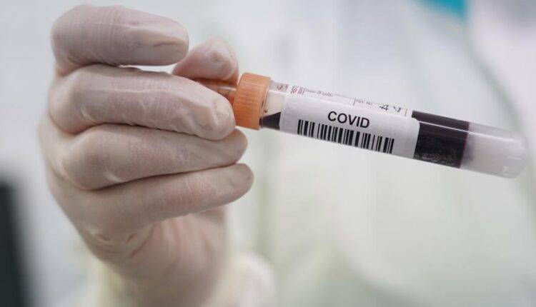 Центр CMD запустил тестирование на антитела к коронавирусу - newtvnews.ru - Россия - Москва
