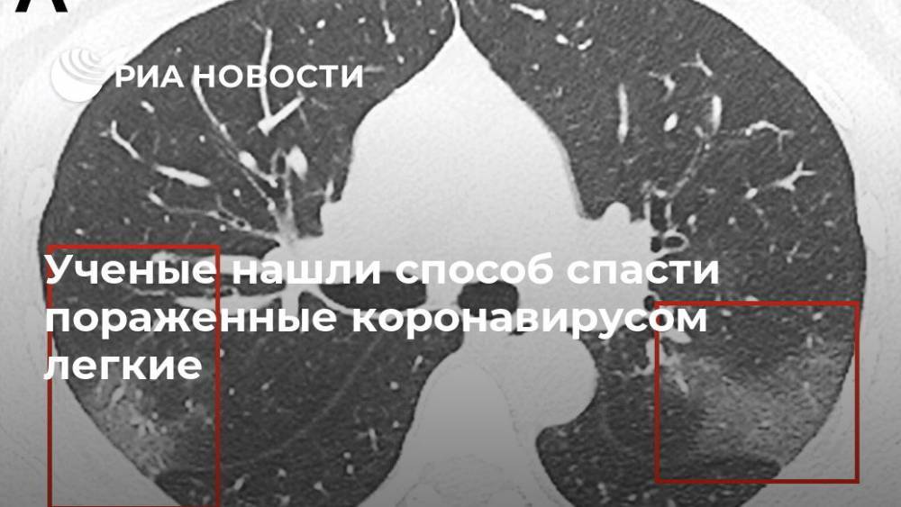 Ученые нашли способ спасти пораженные коронавирусом легкие - ria.ru - Москва