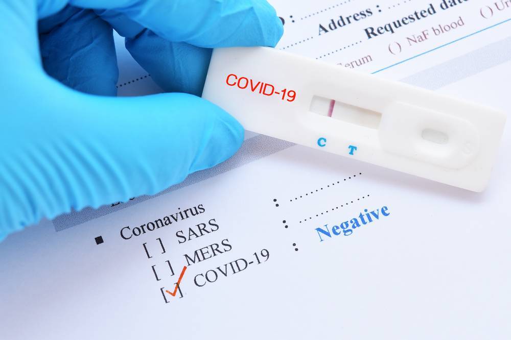 В США заявили о ненадежности тестов на антитела к коронавирусу - naviny.by - Сша