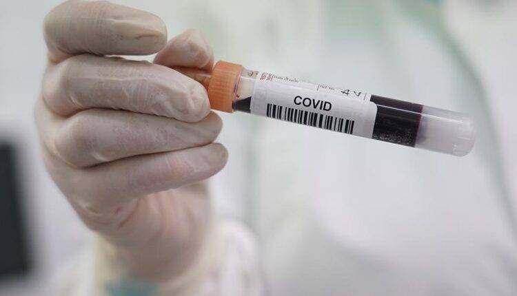 Ученые обнаружили странную особенность коронавируса - newtvnews.ru