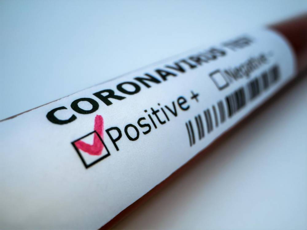 За сутки коронавирус в Украине выявили у 429 человек - gordonua.com - Украина