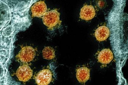 Определена новая смертельная опасность коронавируса - lenta.ru - Сша - Англия - Канада - Испания