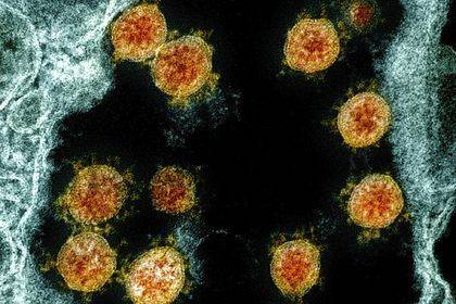 Определена новая смертельная опасность коронавируса - usa.one - Сша - Англия - Канада - Испания
