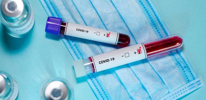В Запорожье коронавирус подтвердился у 10 новых пациентов - inform.zp.ua - Франция - Египет - Испания - Израиль - Польша - Запорожье