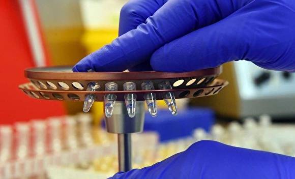 На Ямале начали тестировать на коронавирус еще в двух лабораториях. Но не всех желающих - znak.com - округ Янао - Ноябрьск - Салехард - Губкинский
