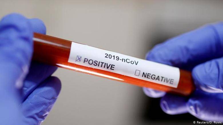 Российские тесты на коронавирус назвали "крайне неточными" - newizv.ru - Новосибирск