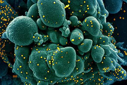 В США одобрили проведение домашних тестов на коронавирус по слюне - lenta.ru - Сша