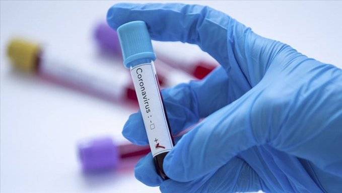 Ученые оценили влияние климата на скорость распространения коронавиурса - vm.ru