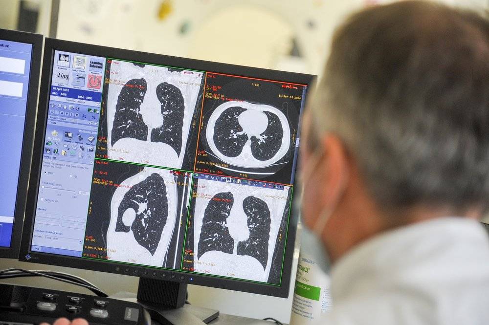 Ученые объяснили развитие рака легких у некурящих людей - vm.ru - Колумбия