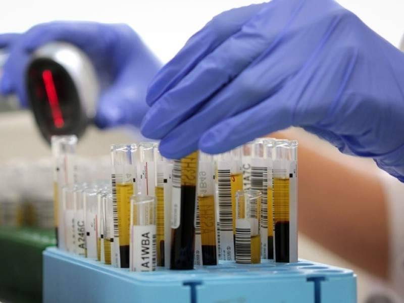 Ученые назвали устойчивую к COVID-19 группу крови - dayonline.ru