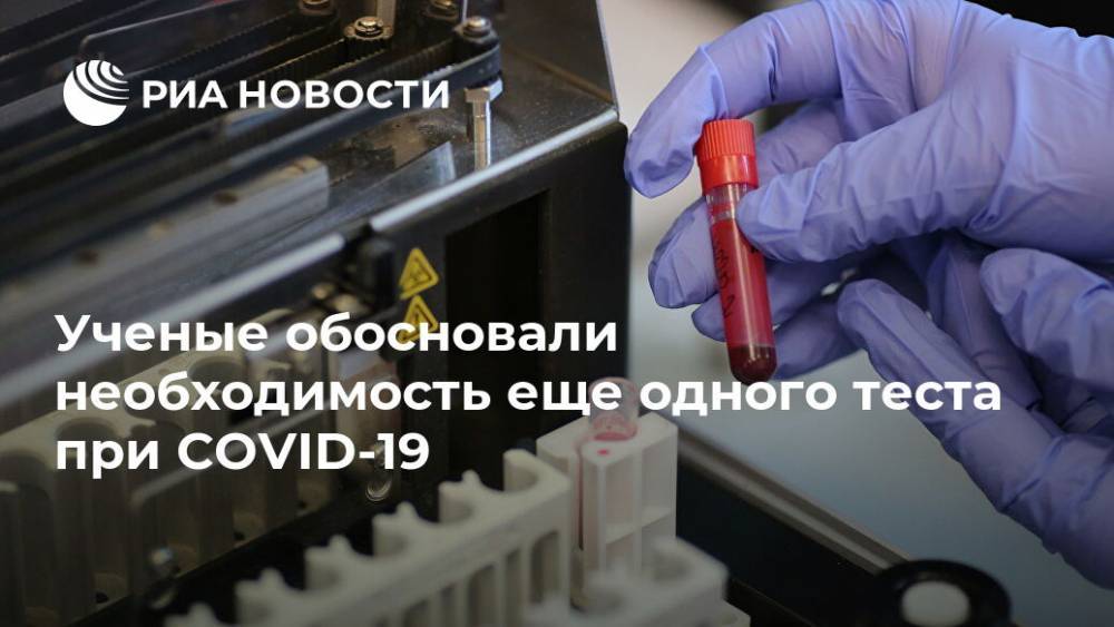 Ученые обосновали необходимость еще одного теста при COVID-19 - ria.ru - Москва - Сша