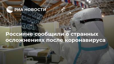Россияне сообщили о странных осложнениях после коронавируса - ria.ru - Москва