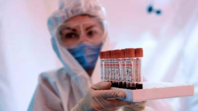 На Украине за сутки выявили 4766 новых случаев коронавируса - russian.rt.com - Украина