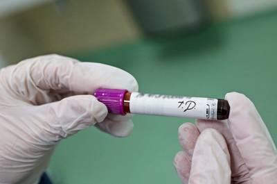 Ученые назвали наиболее устойчивую к коронавирусу группу крови - pnp.ru