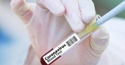 Названо количество россиян, готовых сделать прививку от коронавируса - ren.tv - Россия