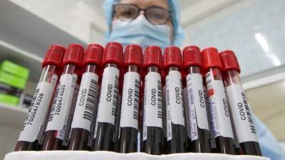 Коронавирус поставил рекорд по числу заболевших в сутки за все время пандемии - 5-tv.ru - Франция