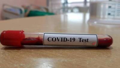 Новый антирекорд коронавируса: за сутки обнаружили 10 842 случая - ru.espreso.tv - Украина - Киев