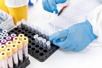 В клинике «Профессор» псковичи могут срочно сдать анализы на COVID-19 - mk-pskov.ru - Псков