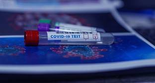 Дагестан обогнал Карачаево-Черкесию по числу новых случаев COVID-19 - kavkaz-uzel.eu - республика Дагестан - Ставрополье край - республика Карачаево-Черкесия - округ Скфо