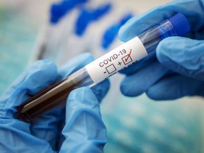 Ускорить выдачу результатов по коронавирусным тестам можно с помощью частных лабораторий - врач - golos.ua - Украина