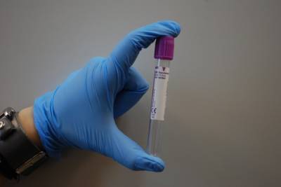Студенты-медики теперь могут самостоятельно брать тесты на коронавирус - nakanune.ru - Россия