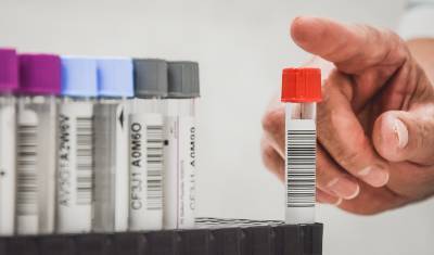 145 жителей Тюменской области привезли из-за границы коронавирус - nashgorod.ru - Тюменская обл.