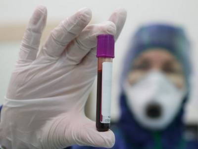 В России за сутки число случаев коронавируса подскочило более чем на 22 тысячи - rosbalt.ru - Россия
