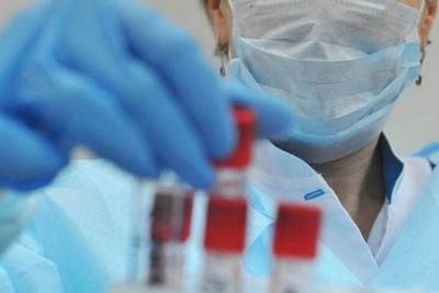 На Кубани коронавирусом заразились 158 человек, в Адыгее - 75 - kuban.mk.ru - Россия - Краснодарский край - республика Адыгея