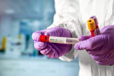 Украинские лаборатории закупают тесты на коронавирус у России - news-front.info - Россия - Украина