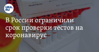 Роспотребнадзор ограничил срок проверки тестов на коронавирус - ura.news - Россия