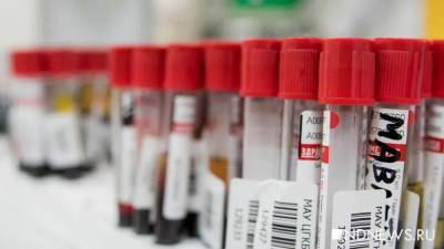 В Италии обнаружили антитела к коронавирусу в анализах, взятых осенью 2019 года - newdaynews.ru - Италия