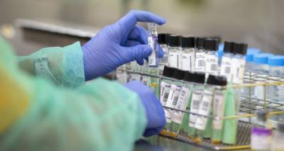 Более 40 смертей: обнародованы новые данные по коронавирусу в Грузии - sputnik-georgia.ru - Грузия - Тбилиси