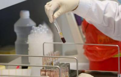 В России за сутки скончались 442 человека с коронавирусом – это максимум с начала пандемии - argumenti.ru - Россия - Санкт-Петербург - Москва - Красноярский край